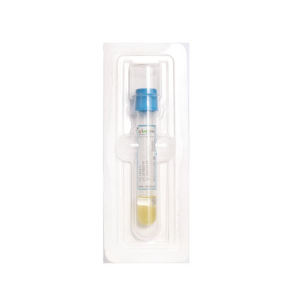 8ML PRP 시험관